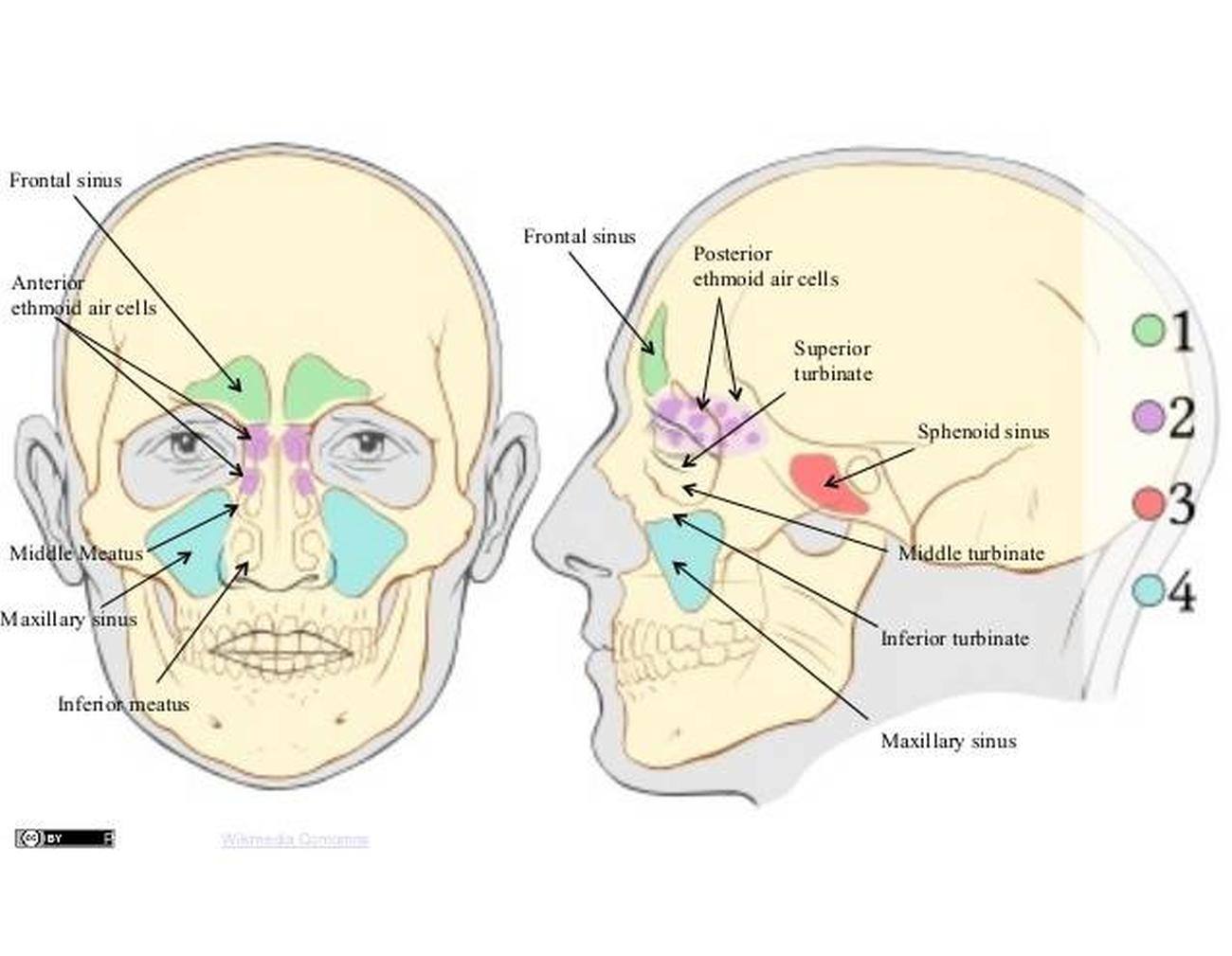 Facial Bones Ethmoid Air Cells At Anna Tichenor Blog