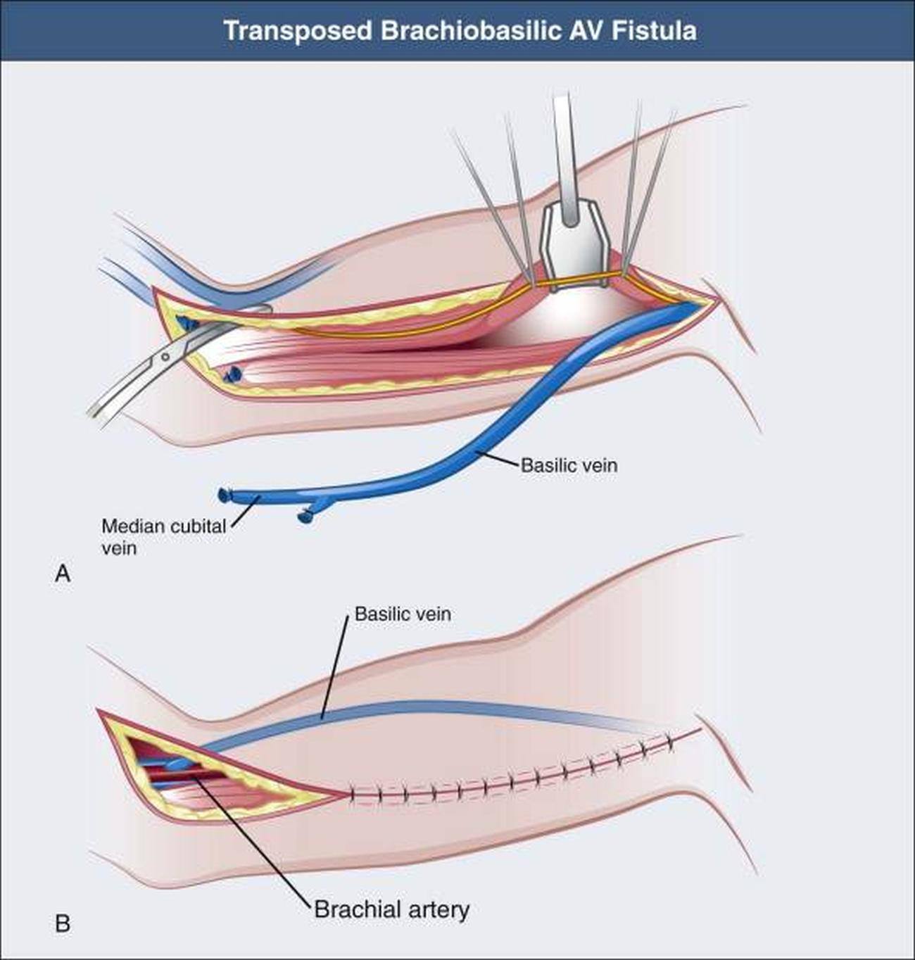 Pictures of Basilic Vein 683