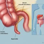 Appendix Diagram