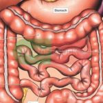 Appendix Diagram