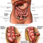 Appendix Diagram