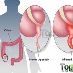 Appendix Diagram