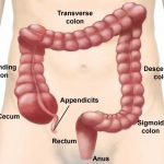 Appendix Diagram