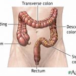 Colon diagram