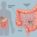 Colon diagram