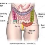 Colon diagram