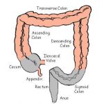 Colon diagram