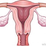 Diagram of uterus