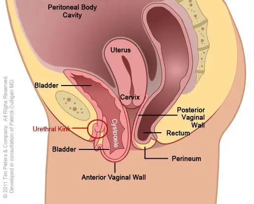Diagram of uterus