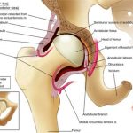 Hip diagram