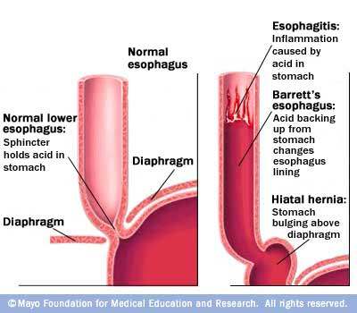 Oesophagus diagram