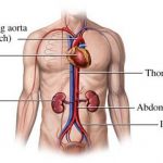 Pictures Of Abdominal Aorta