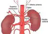 Pictures Of Abdominal Aorta