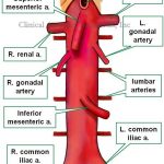 Pictures Of Abdominal Aorta