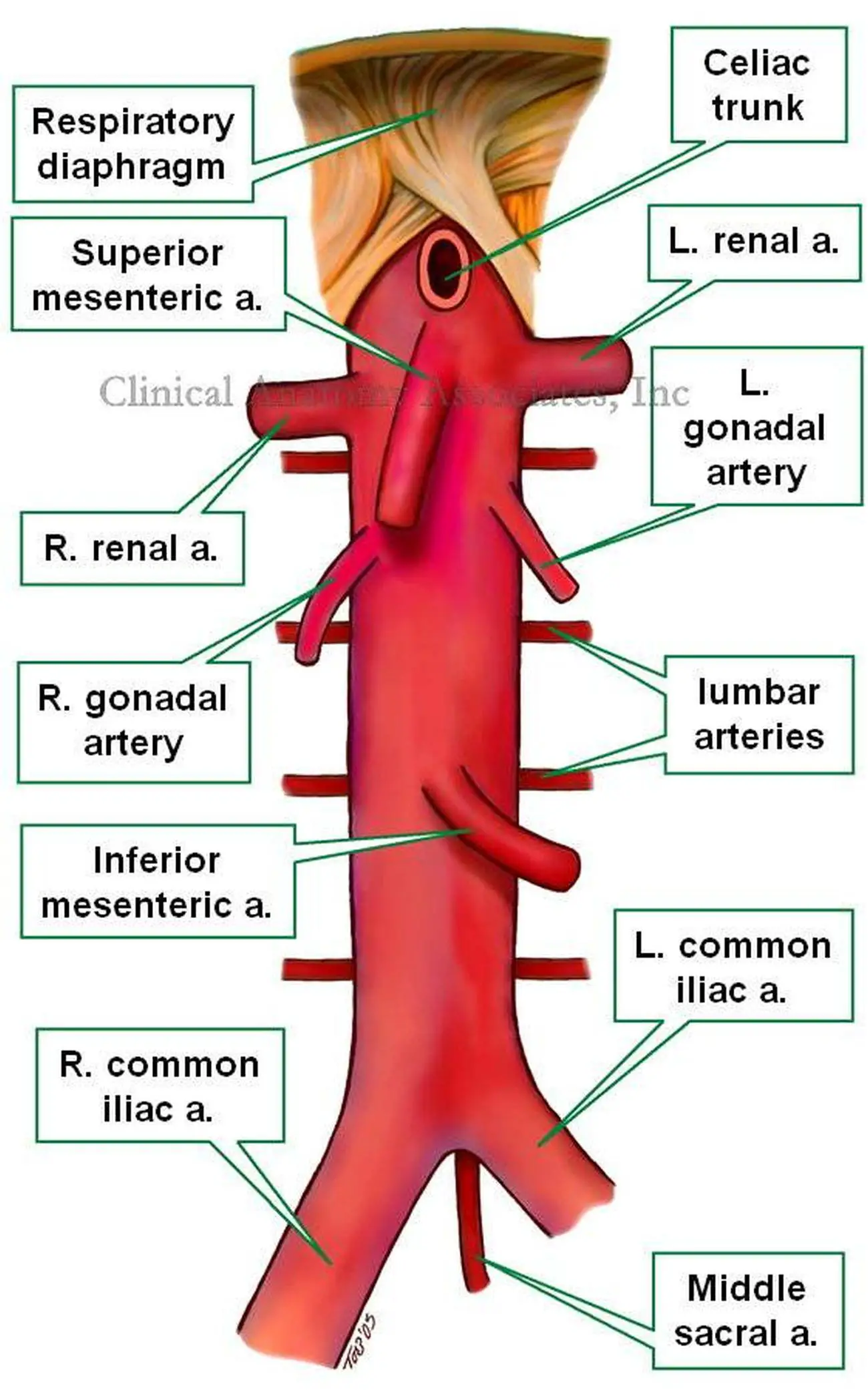 Pictures Of Abdominal Aorta