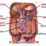 Pictures Of Abdominal Aorta