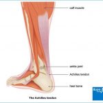 Pictures Of Achilles Tendon