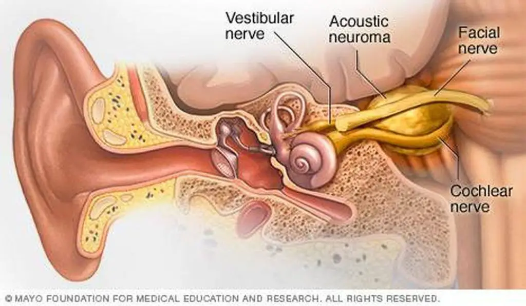 pictures-of-acoustic-nerve