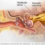 Pictures Of Acoustic Nerve