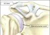 Pictures Of Acromioclavicular Ligaments
