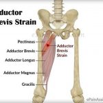 Pictures Of Adductor Brevis