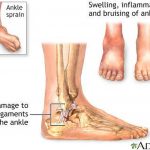 Pictures Of Ankle