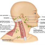 Pictures Of Anterior Cervical Lymph Nodes