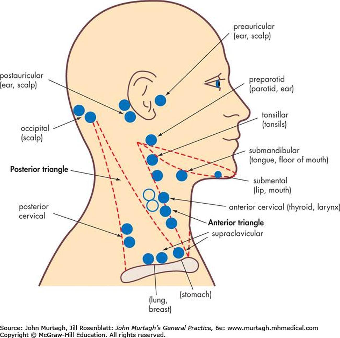 pain on lymph node back of head