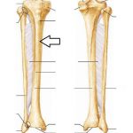 Pictures Of Anterior Crest Of The Tibia