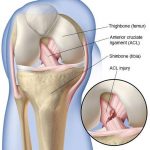 Pictures Of Anterior Cruciate Ligament