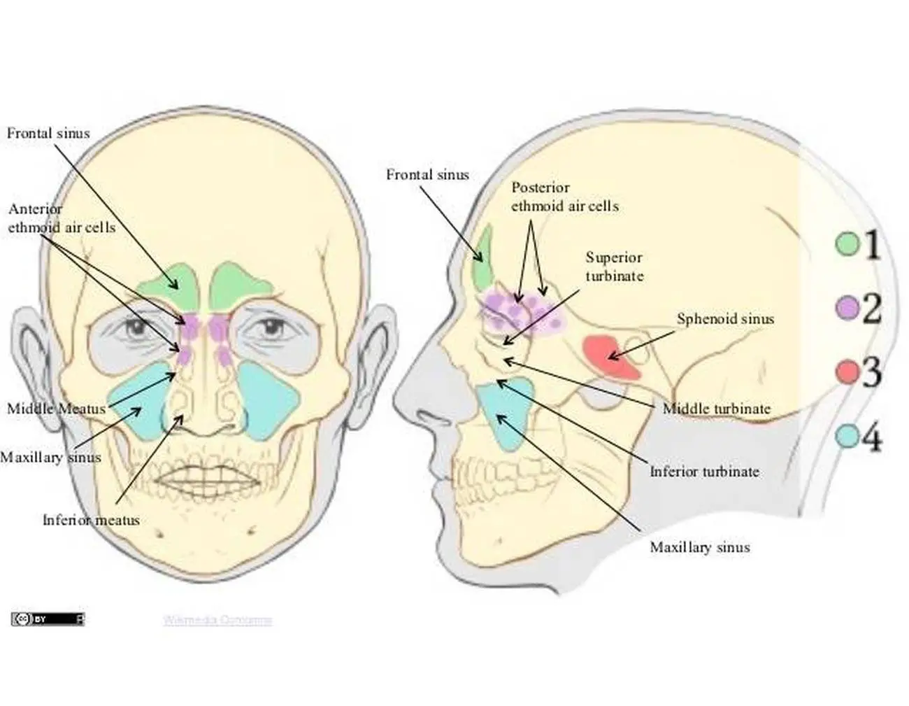 Pictures Of Anterior Ethmoid Sinuses