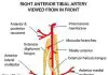 Pictures Of Anterior Tibial Artery