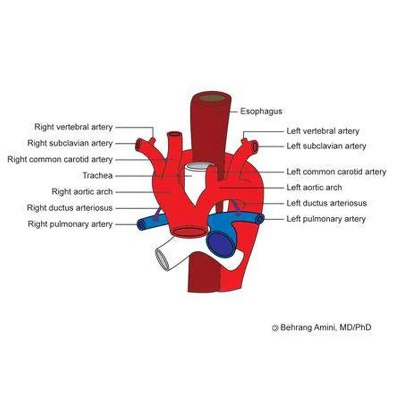 Pictures Of Aortic Arch