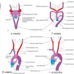 Pictures Of Aortic Arch