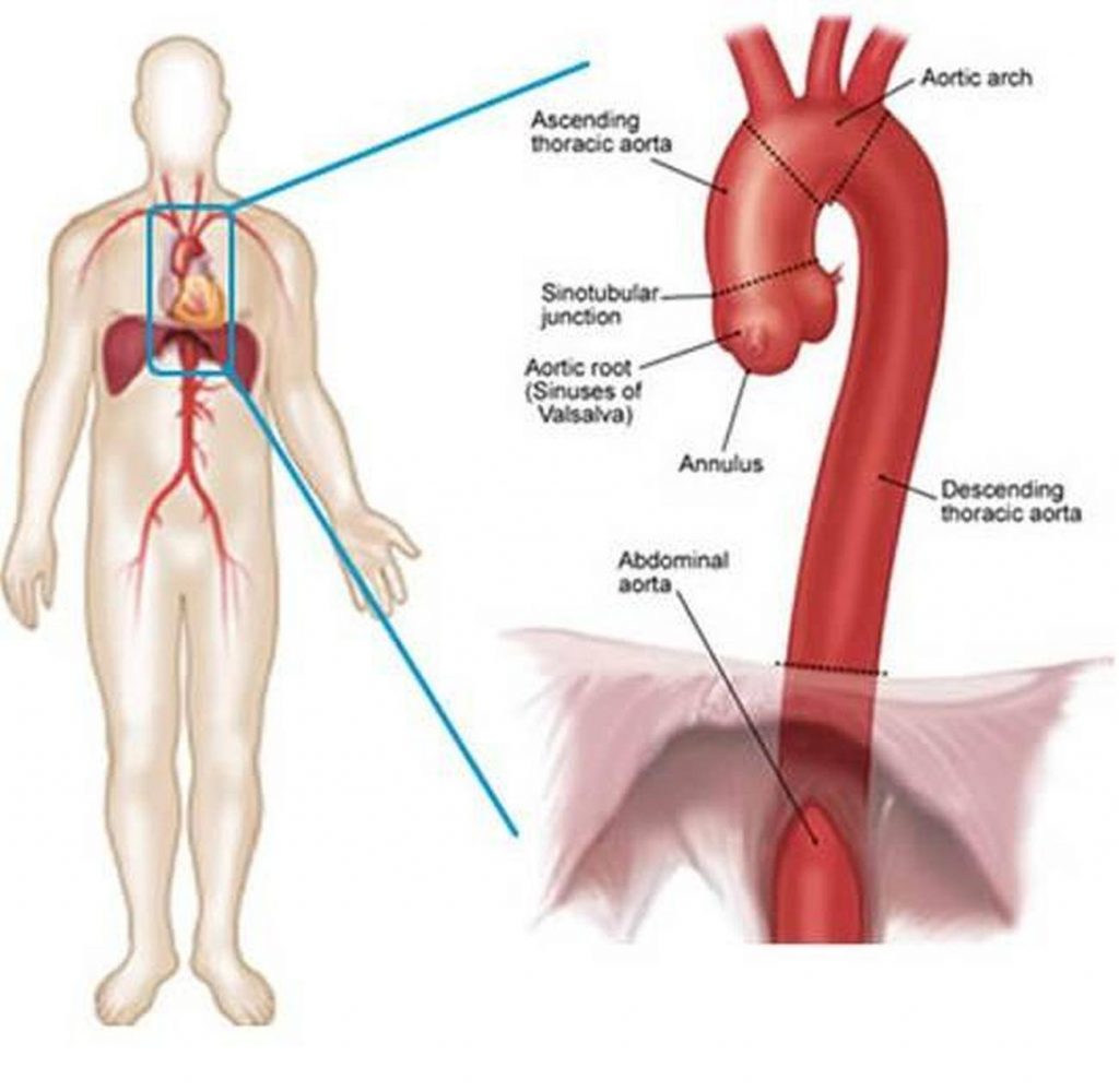 Pictures of aortic arch