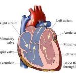 Pictures Of Aortic Valve