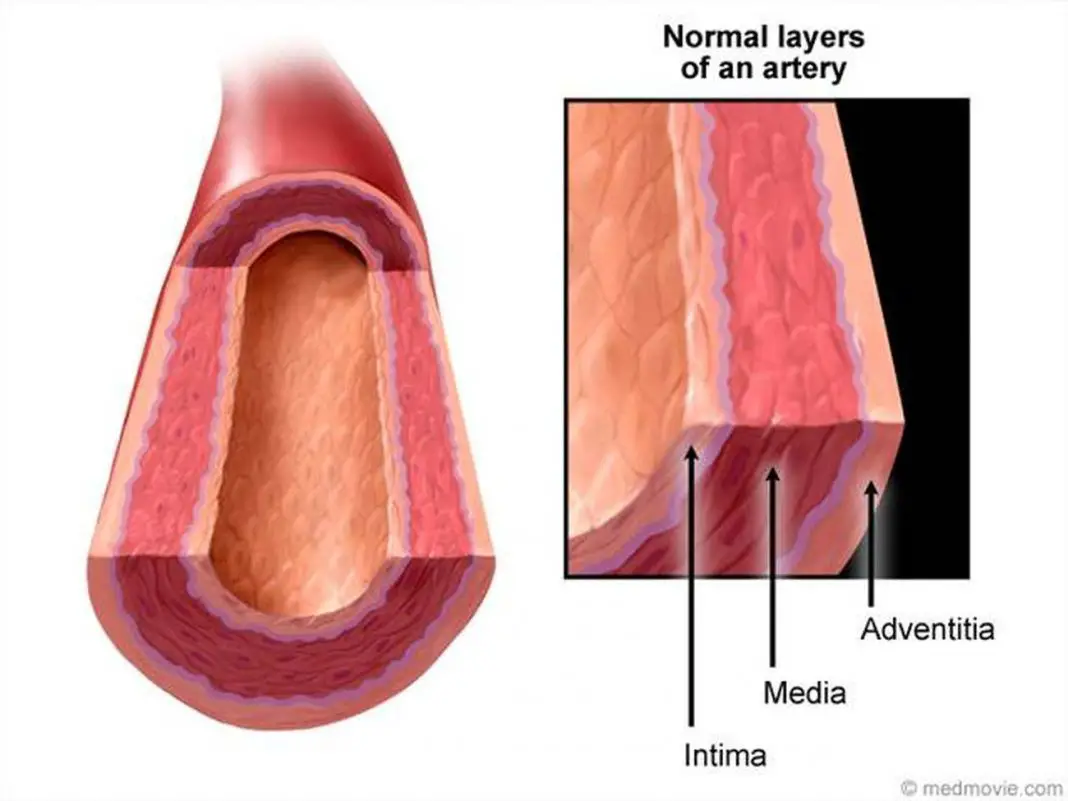Pictures Of Artery