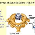 Pictures Of Atlas Axis Joint