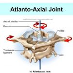Pictures Of Atlas Axis Joint