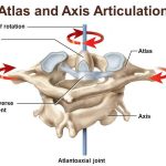 Pictures Of Atlas Axis Joint