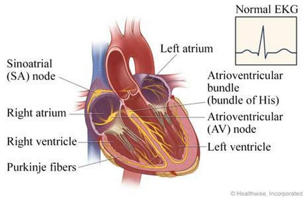 Pictures Of Atrioventricular Node
