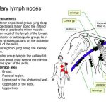 Pictures Of Axillary Lymph Nodes