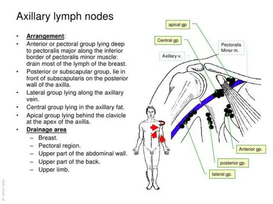 Pictures Of Axillary Lymph Nodes