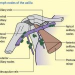 Pictures Of Axillary Lymph Nodes