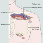 Pictures Of Axillary Vein
