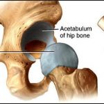 Pictures Of Ball And Socket Joint