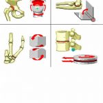 Pictures Of Ball And Socket Joint