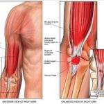 Pictures Of Biceps Brachii Tendons