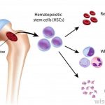 Pictures Of Bone Marrow