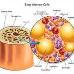 Pictures Of Bone Marrow